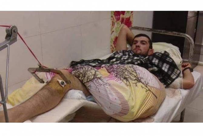 В Арцахе азербайджанскому военнопленному оказывается медицинская помощь, он прооперирован 